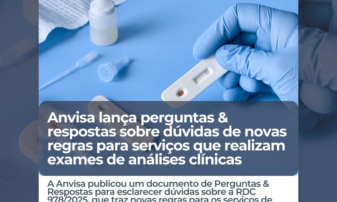 Anvisa-duvidas-exames-analises-clinicas